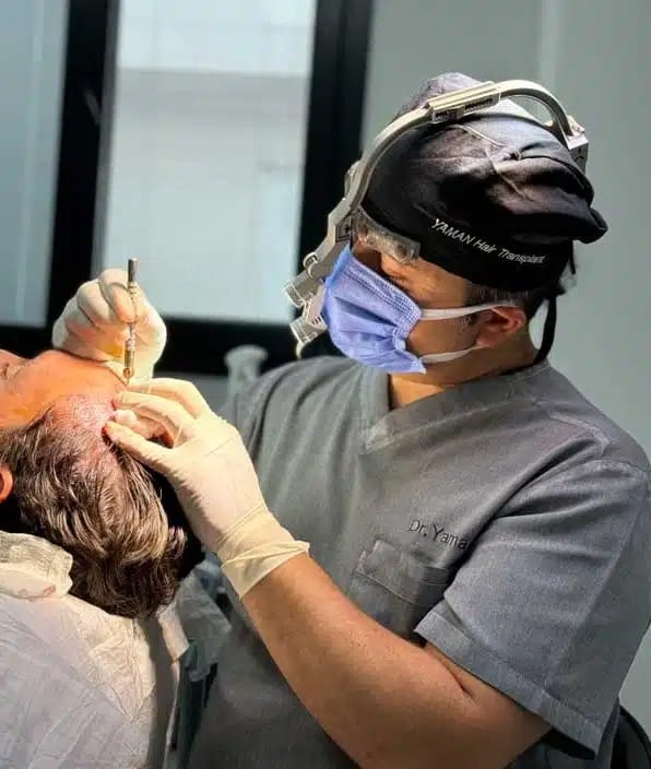 Hair Transplant Before and After